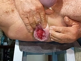 扩肛侠2025-14 young gay chinese boy porn