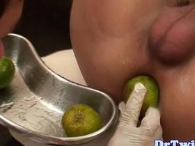 大号假阳具检查亚洲嫩鸡前列腺 chinese gay porn twitter